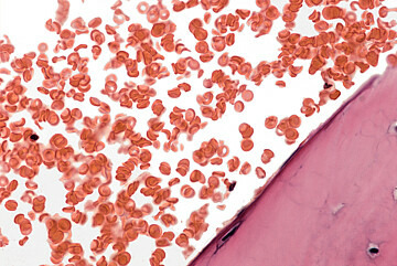 Abbildung von Haemoglobin