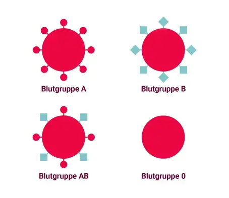 Zu sehen ist eine grafische Darstellung der jeweiligen Blutgruppen A,B,AB und 0 mit den jeweiligen anliegenden Antigenen auf der H&uuml;lle der roten Blutk&ouml;rperchen.