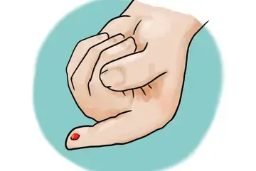 Zu sehen in einer Zeichnung ist eine Hand. Der Zeigefinger ist gestreckt und man sieht dort einen Blutstropfen.