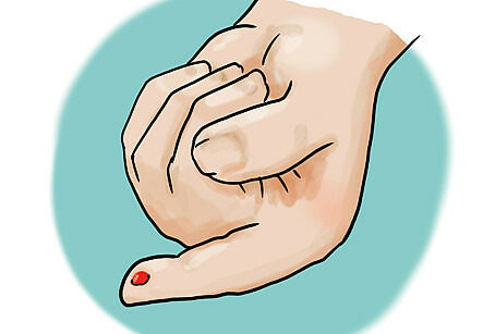 Zu sehen in einer Zeichnung ist eine Hand. Der Zeigefinger ist gestreckt und man sieht dort einen Blutstropfen.