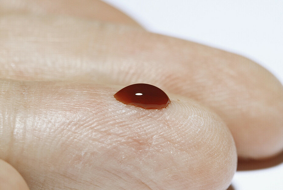 Foto der Fingerspitzen eines Menschen mit einem kleinen Tropfen Blut auf dem Zeigefinger