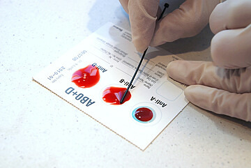 Grafik Blutgruppenbestimmung. Hand und Teststreifen.