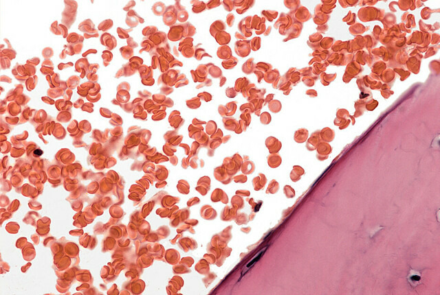 Abbildung von Haemoglobin
